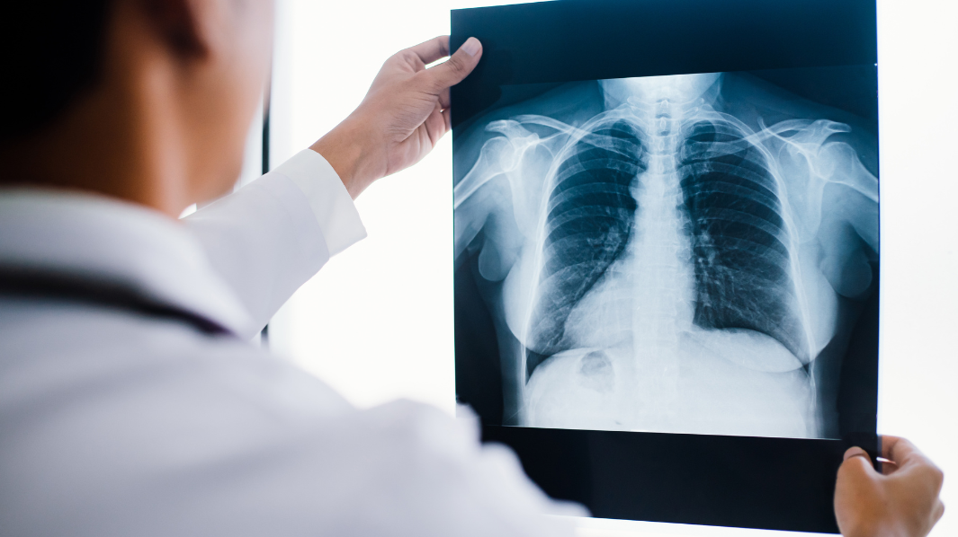 X ray