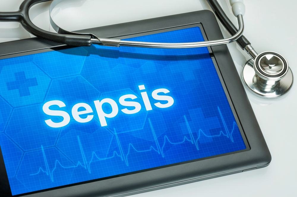 Sepsis Treatment