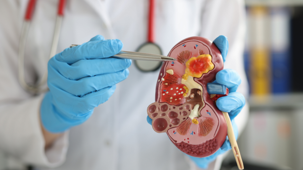 Urology and kidney stones